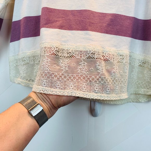 Kirra Striped Jersey with Lace Embellishment - Picture 4 of 8